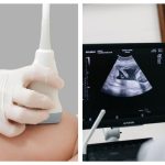 Ультразвукове дослідження грудних залоз у Дніпрі 2026